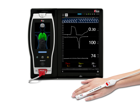 Product shot of masimo root with ORi and a hand wearing a masimo sensor