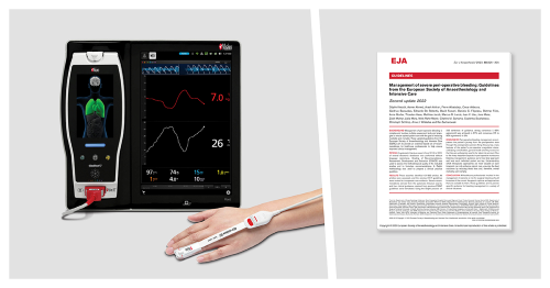 Masimo Root®&nbsp;with PVi®