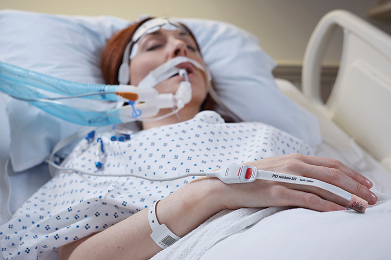 patient intubé